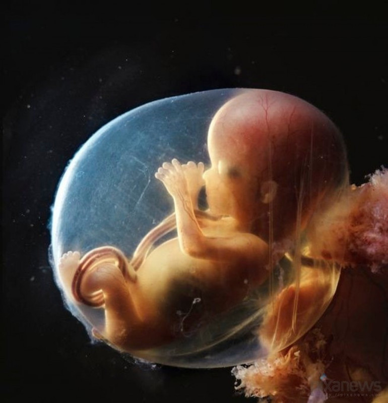 Fetus fotoğraflarıyla tanınan ünlü sanatçı hayatını kaybetti