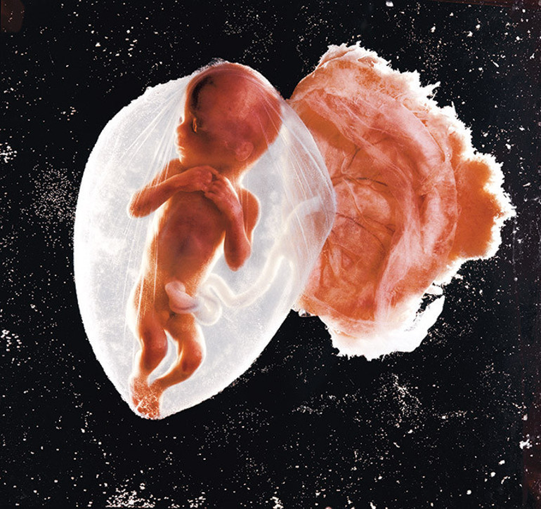 Fetus fotoğraflarıyla tanınan ünlü sanatçı hayatını kaybetti