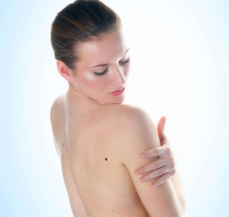 Saat başı 1 kişi melanomdan ölüyor