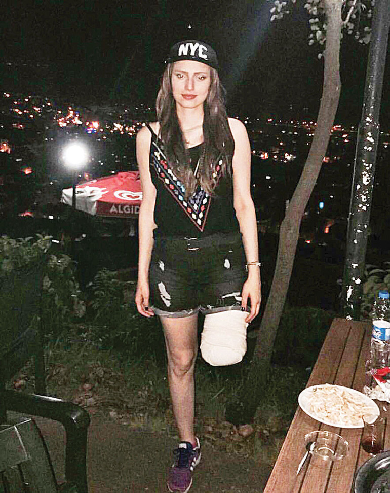 Bacağım yok ama yaşam sevincim var