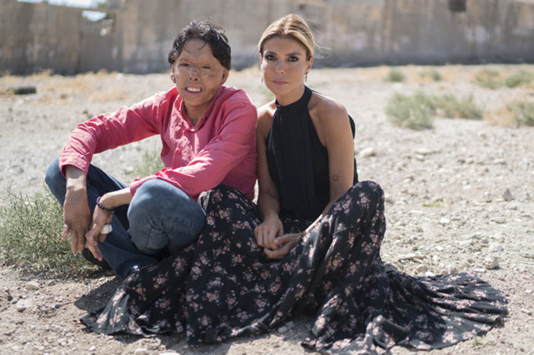 Kilis’te savaşın bitmeyen izleri