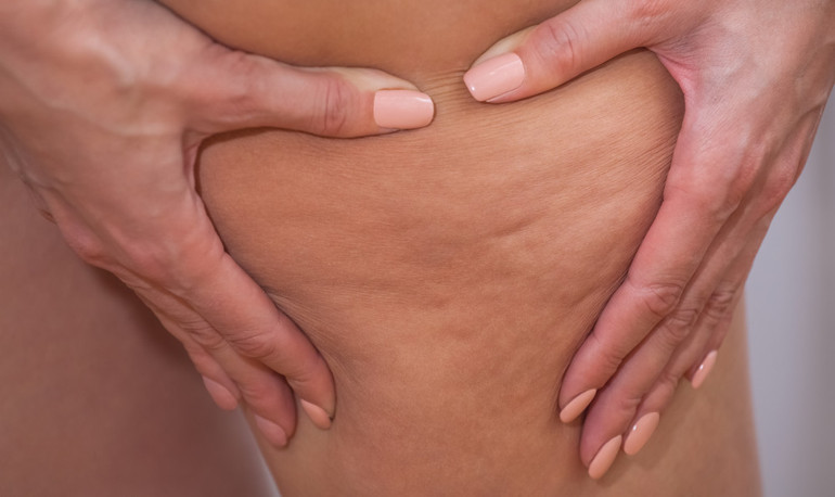 Vücut yağına dair 4 yaygın yanlış bilgi