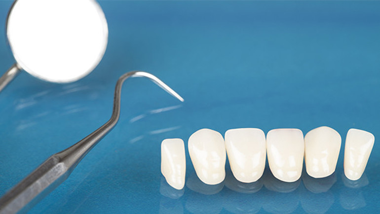 Bir günde yeni dişlere kavuşmak mümkün