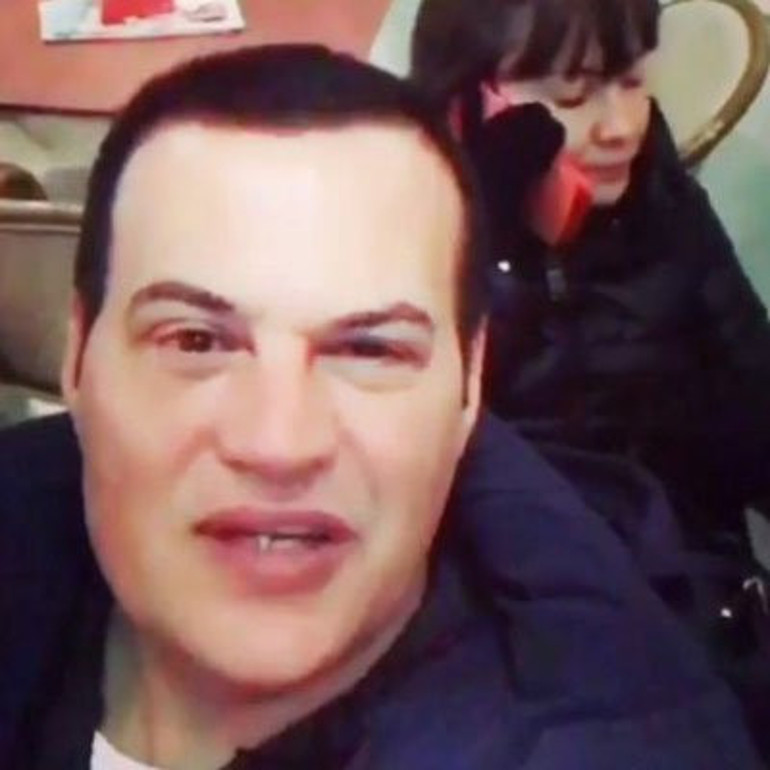 Hakan Pekerin son hali herkesi şaşırttı