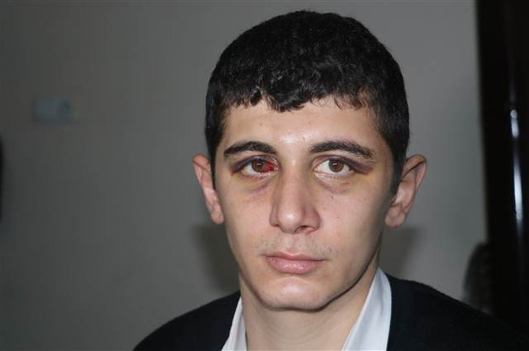 Flaş gelişme: Engelli gence tekme ve yumruklarla saldıran 4 kişi tutuklandı