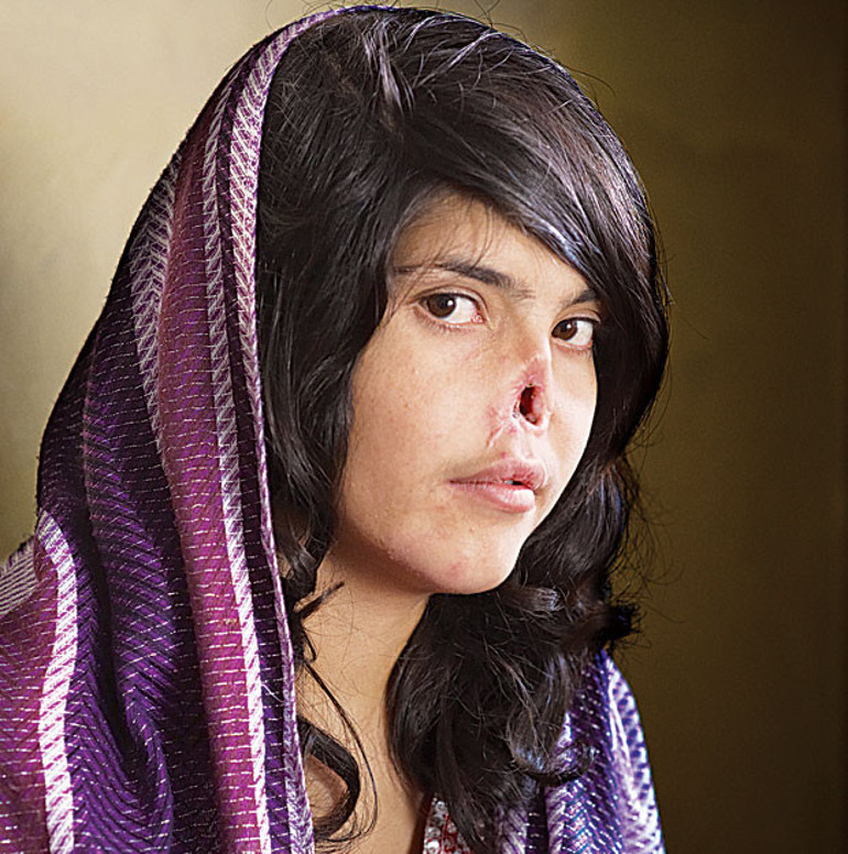 Bir fotoğrafla hayatı değişti