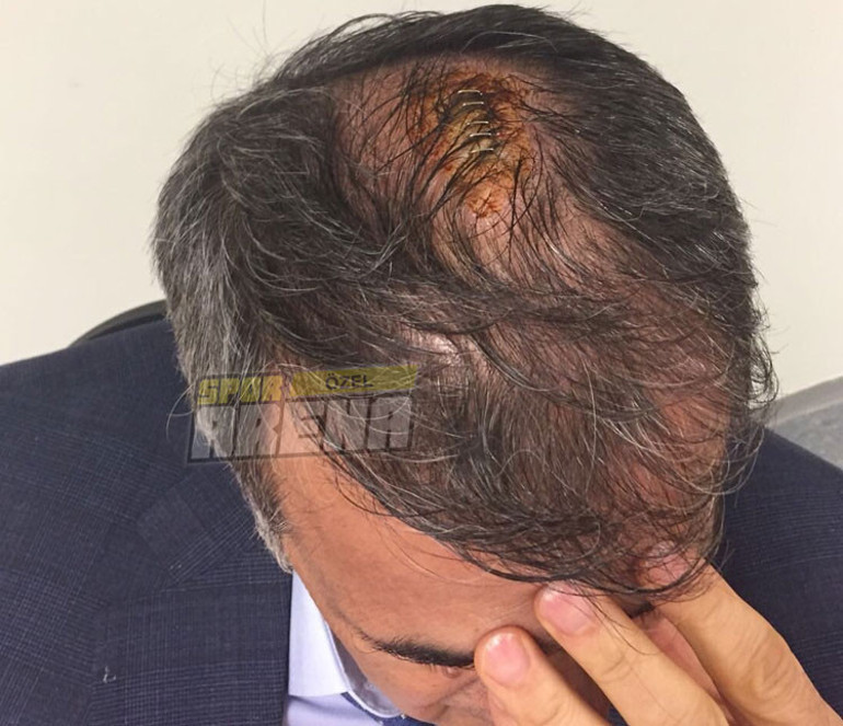 BJK TVden olay iddia... Şenol Güneşe sedyede saldırdılar