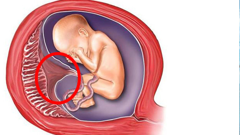 Plasenta nedir Bebeğin plasentası nedir
