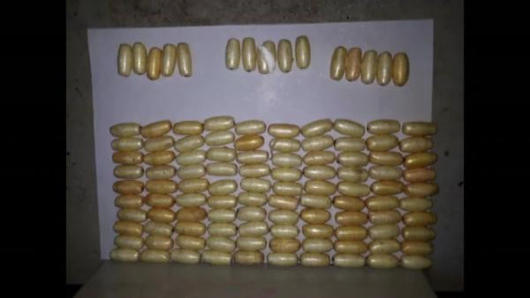 Yer Atatürk Havalimanı... Midesinden 115 prezervatif çıktı...