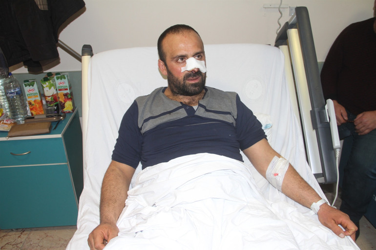 Burnunu ve bacağını parçaladılar Yumrukla vurdum ama bırakmadılar