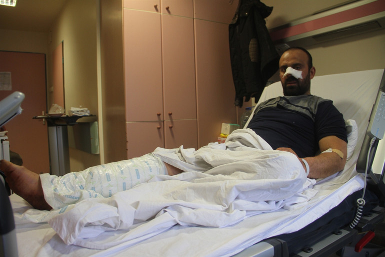 Burnunu ve bacağını parçaladılar Yumrukla vurdum ama bırakmadılar