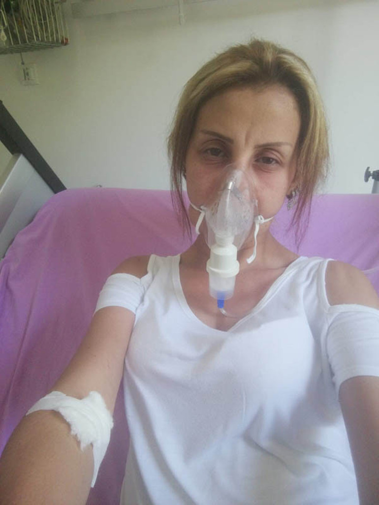 Saçlarını yaptırmak için kuaföre gitti, canından oluyordu Yüzü tanınmayacak hale geldi...