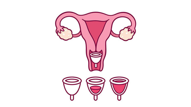 Menstrual Kap Nedir Nasıl Kullanılır