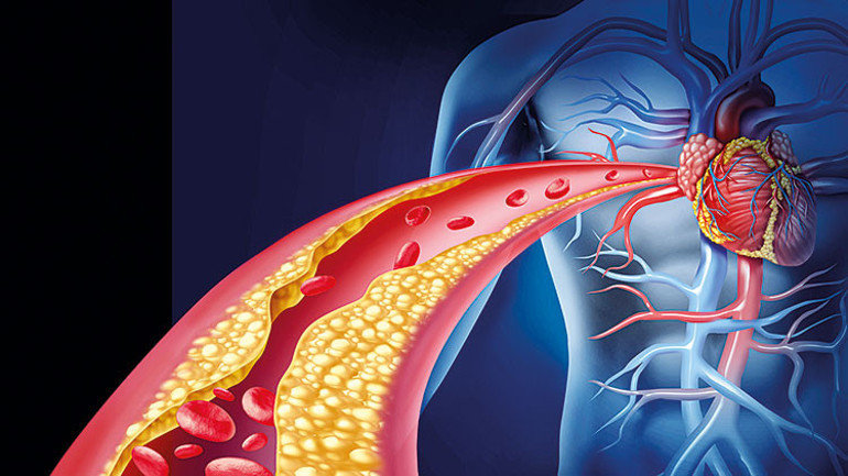 Kolesterol savaşları bitti mi
