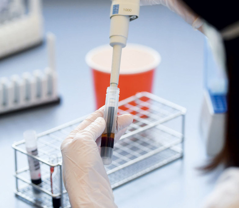 Koronavirüs bulaştıranlara dava açılır mı