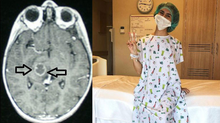 ‘Pilli bebek’ Pelin’in 16 yılda tam 6 kez beyin pili değiştirildi