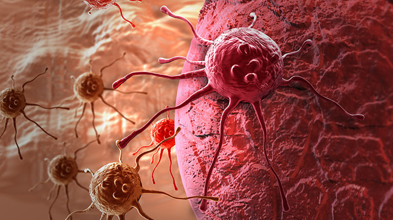 Kolon Kanserinde 8 Risk Faktörüne Dikkat