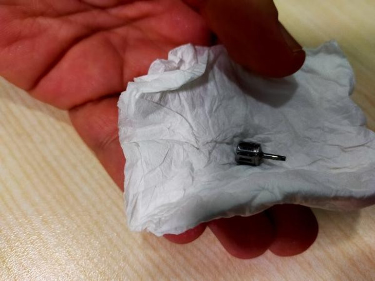 Bursada diş kliniğine giden kadın hayatının şokunu yaşadı