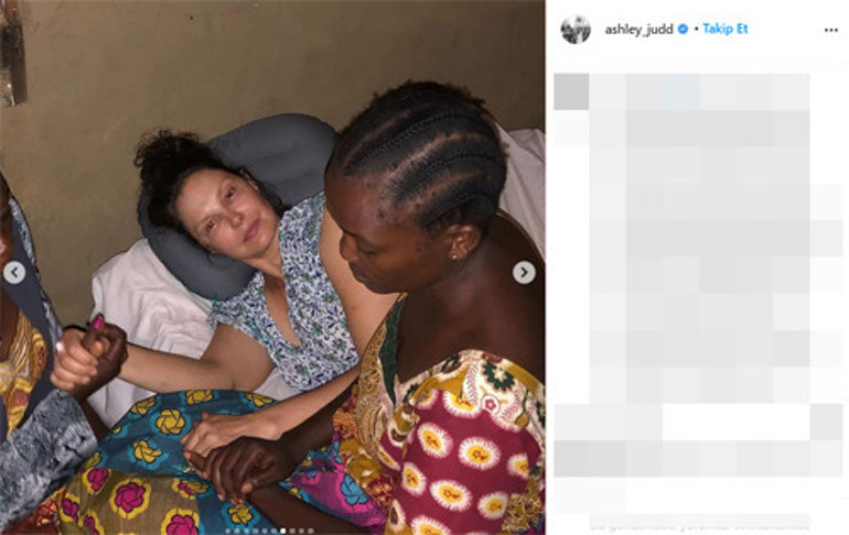 Ünlü oyuncu Ashley Juddın kabus dolu anları: Issız ormanda bacağını kırdı, 55 saatte hastaneye ulaştı