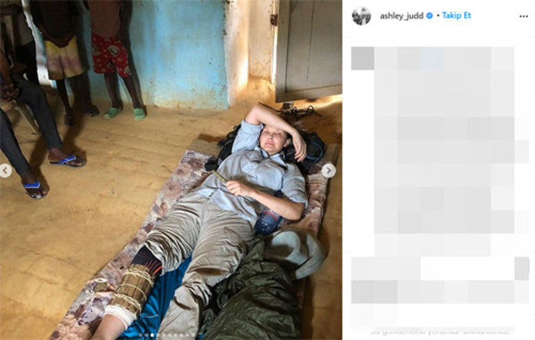 Ünlü oyuncu Ashley Juddın kabus dolu anları: Issız ormanda bacağını kırdı, 55 saatte hastaneye ulaştı