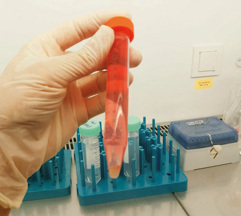 Yapay ete ucuz yerli formül