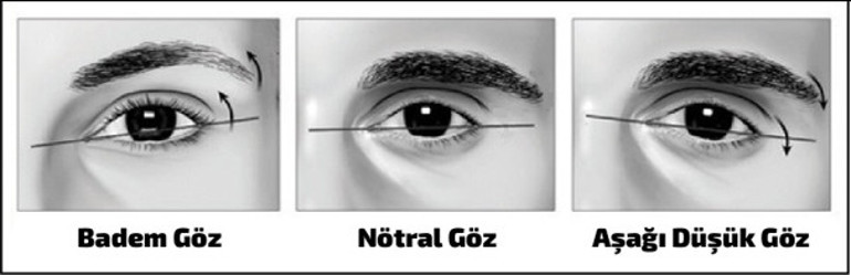 Badem göz ameliyatı