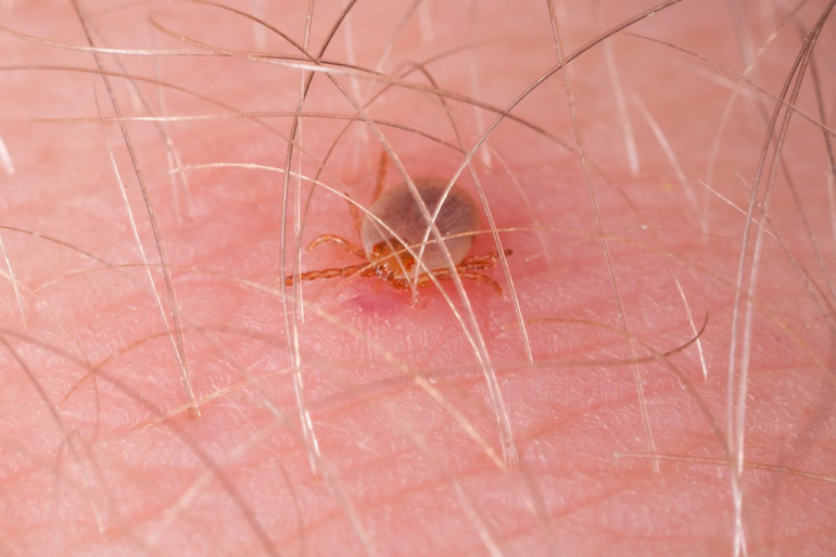 Kırım kongo kanamalı ateşi mi covid-19 mu Belirtileri nasıl ayırt edebiliriz