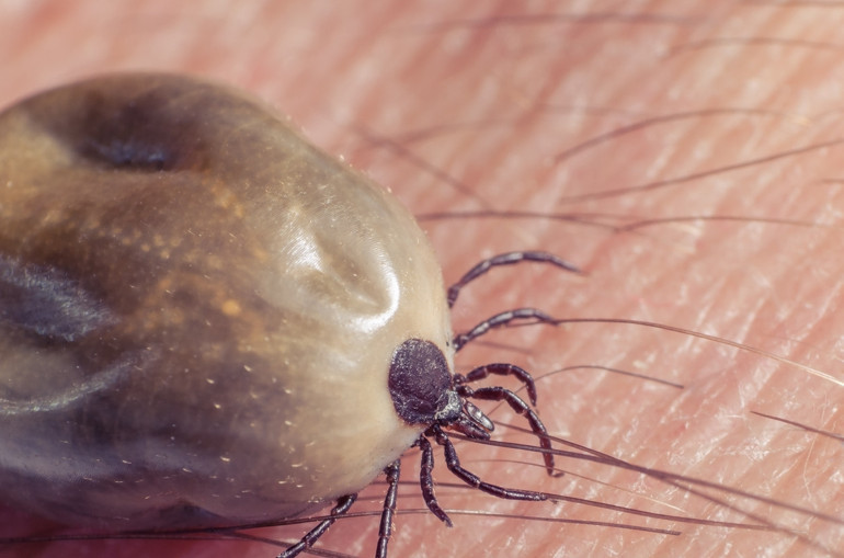 Kırım kongo kanamalı ateşi mi covid-19 mu Belirtileri nasıl ayırt edebiliriz