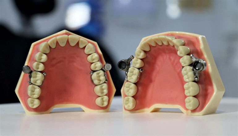 Kilo kontrol cihazına tepki yağıyor... Bunun adı işkence