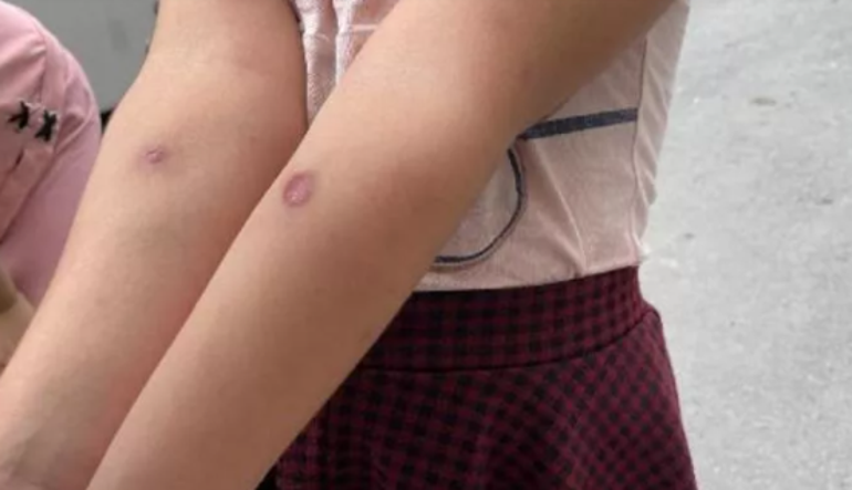 İstanbulluların kâbusu oldular Dikkat çeken sivrisinek haritası