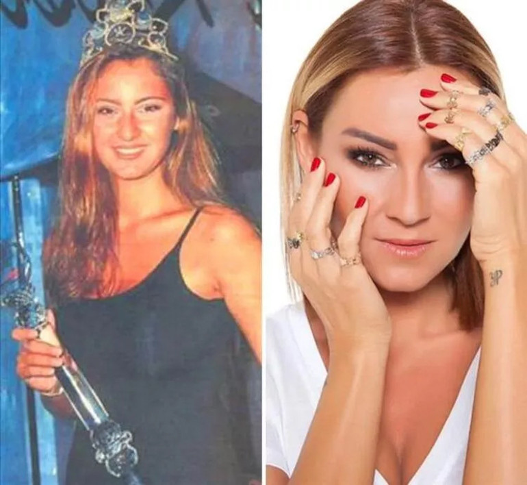 Miss Turkeyde estetikli güzel tartışması: Eskiden dişini yaptırsa elenirdi