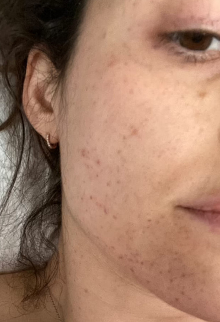Emmy Rossumun anneliğe giden yolculuğu: Adım adım doğuma