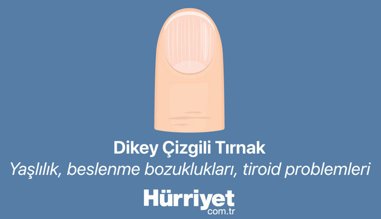 Bana tırnağını göster sana hastalığını söyleyeyim | Milyonlarca izlenen videodan sonra gündem tırnaklar...