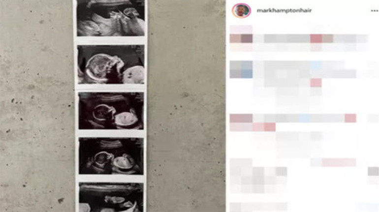 Jennifer Lawrence anne oluyor: Birer birer hamilelik haberleri geldi