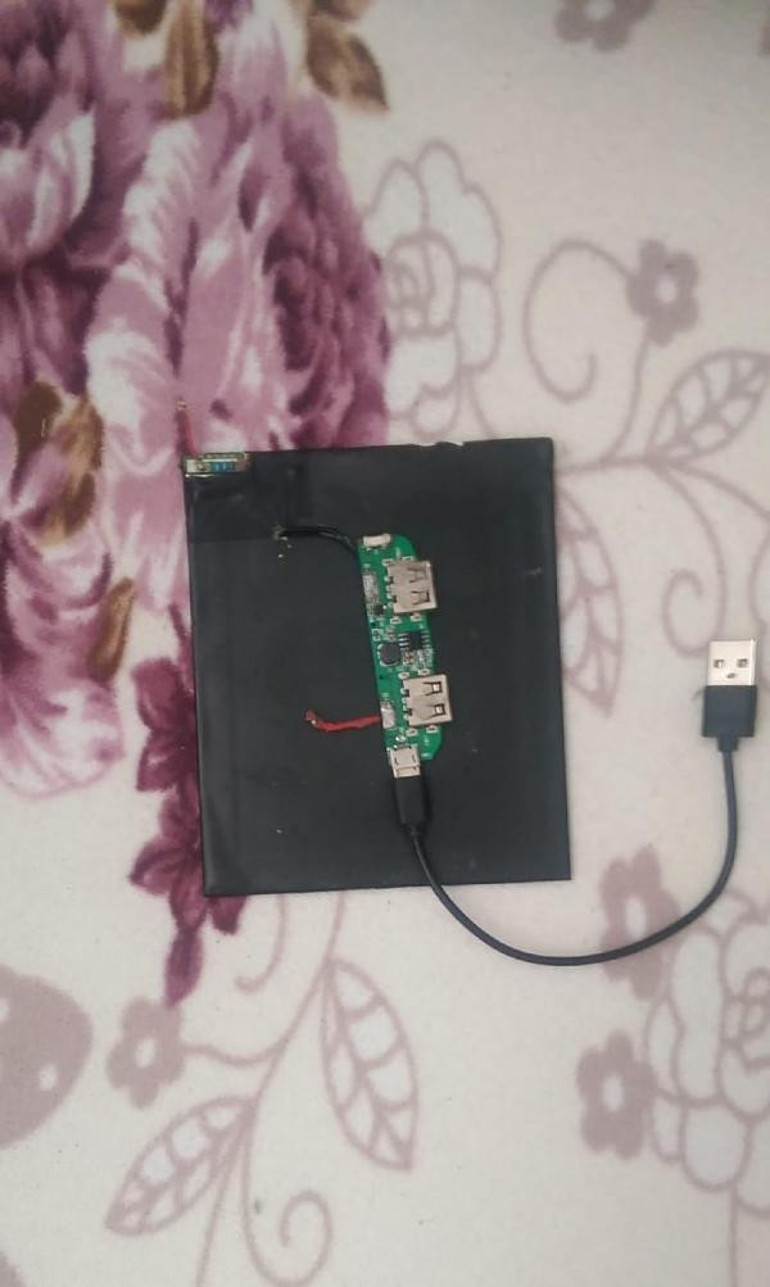 Bomba gibi patlayan powerbank parmağını kopardı
