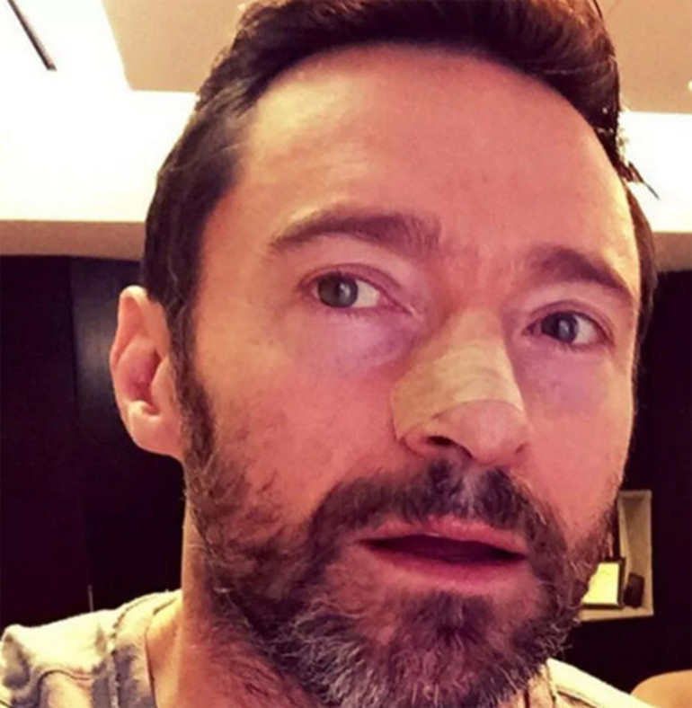 Kanser oldum ama hala kendime gülebiliyorum