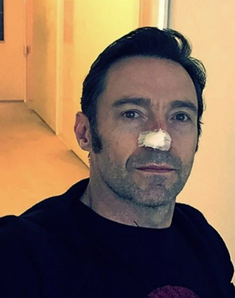 Kanser oldum ama hala kendime gülebiliyorum