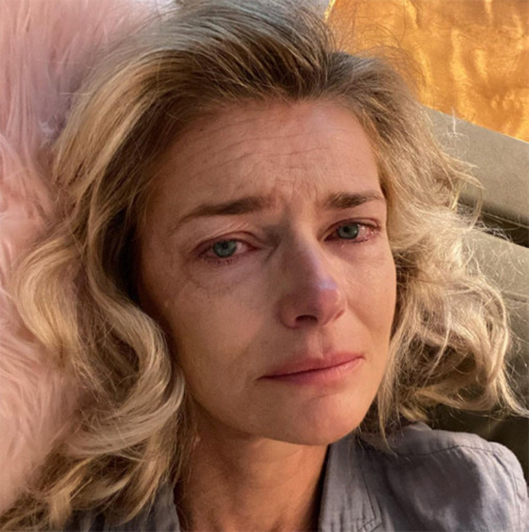 Kanser oldum ama hala kendime gülebiliyorum