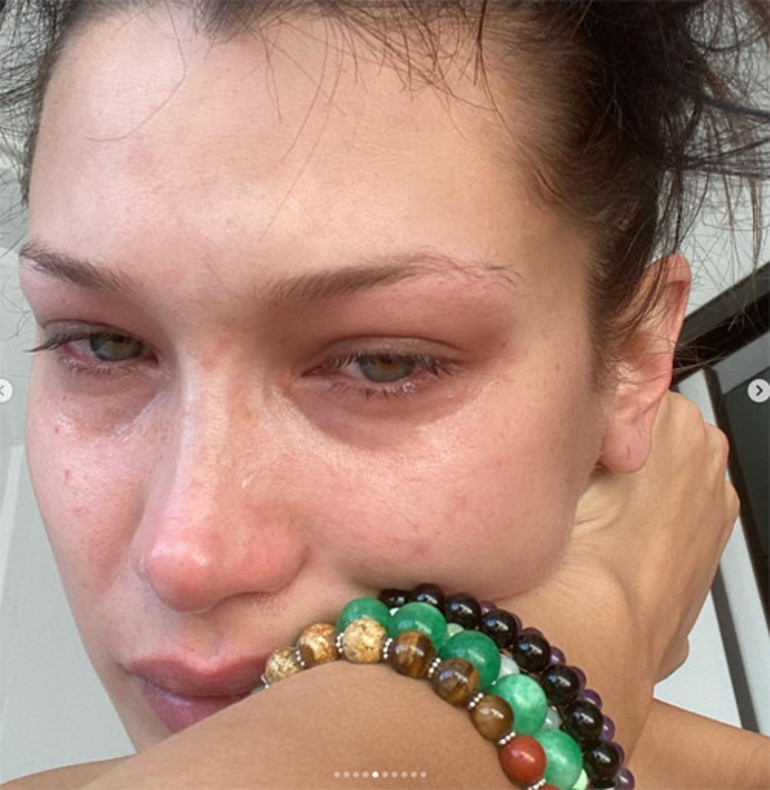 Kanser oldum ama hala kendime gülebiliyorum