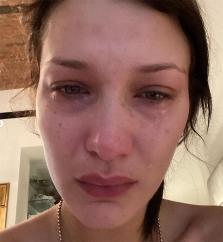 Kanser oldum ama hala kendime gülebiliyorum