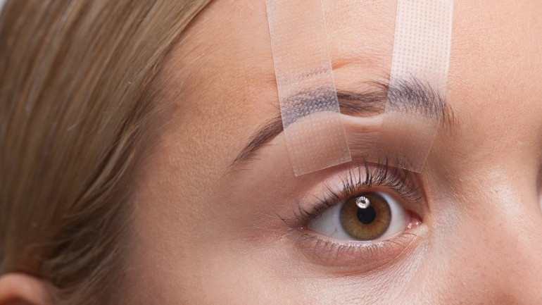 Göz Kapağı Ameliyatı Nasıl, Kimlere Yapılır
