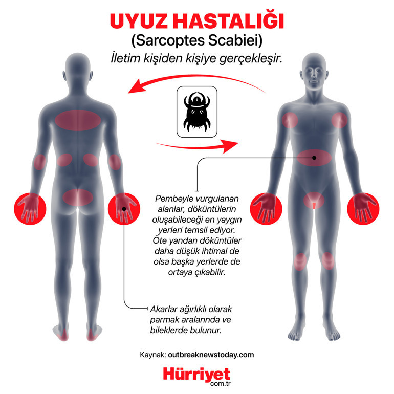 Dikkat uyuz var... Ortak kullanılan şallardan, kabindeki kıyafetlerden bile bulaşıyor