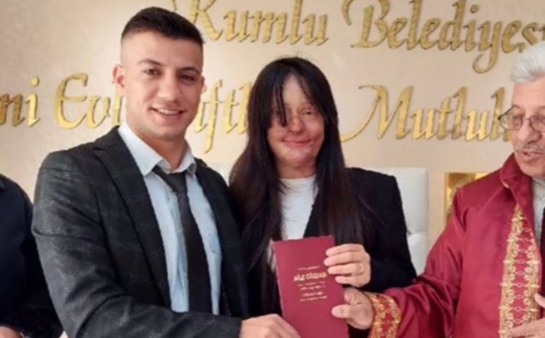 Melis Sezen’in ardından Defne Samyelinin kıyafeti olay oldu