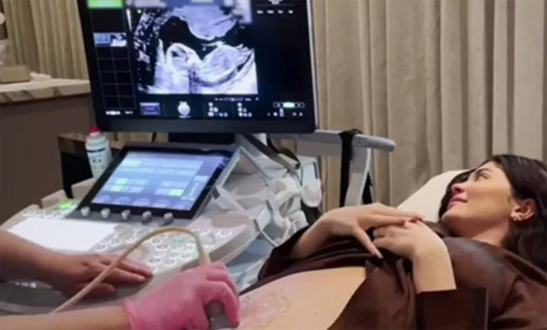 Kylie Jennerdan karnı burnunda paylaşım: Her an doğurabilir
