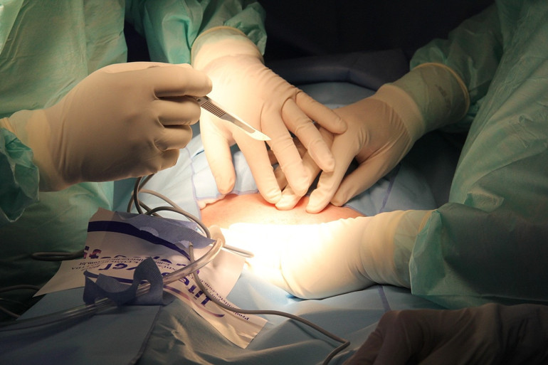 En az 21 çocuğun babası çıktı: Doktor doğurganlık tedavisinde kendi spermlerini kullanmış