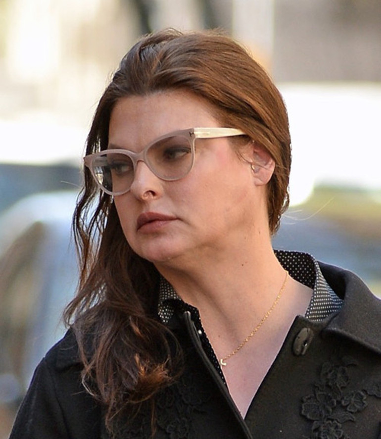Estetik yüzünden kariyeri biten ünlü model Linda Evangelista Sokakta tanıdığım birine rastlamaktan ödüm kopuyor