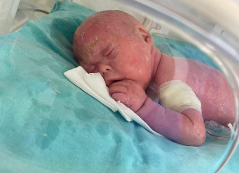 300 binde bir görülen bir hastalıkla doğan Gökdeniz bebeğin hikayesini annesi anlattı: Hayatımın en uzun 3 dakikasıydı