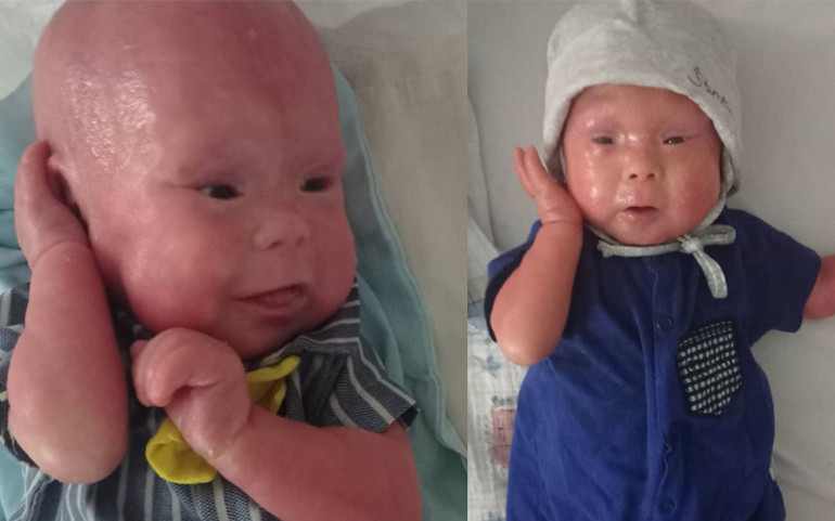 300 binde bir görülen bir hastalıkla doğan Gökdeniz bebeğin hikayesini annesi anlattı: Hayatımın en uzun 3 dakikasıydı