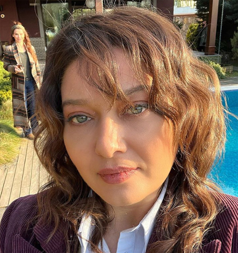 Nurgül Yeşilçay: Büyük bir kaza atlattım Ağzıma, çeneme dikişler atıldı