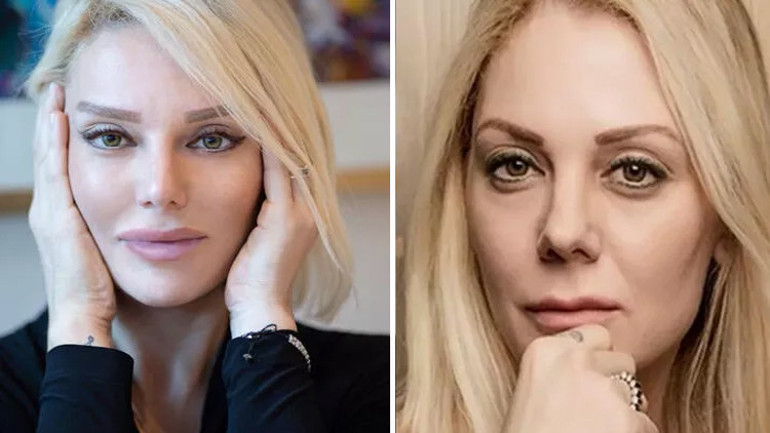 Son hali çok konuşulmuştu... Bengüden açıklama geldi